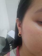 Anonymous review photo