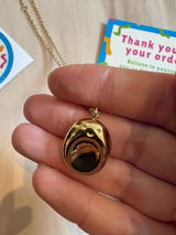 Anonymous review photo