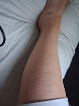 Anonymous review photo