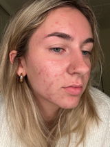 Allie Moeller review photo