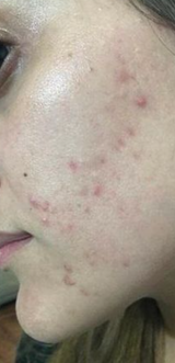 Zaira Cavalcante review photo