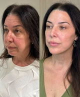 Fernanda Quaresma review photo
