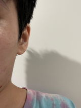 Anonymous review photo