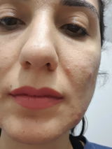 Özlem Kaplan Tunç review photo