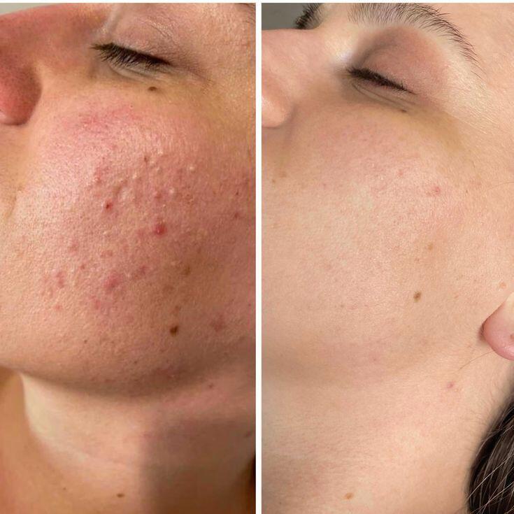 Luisa review photo