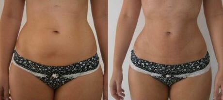 Birgit review photo