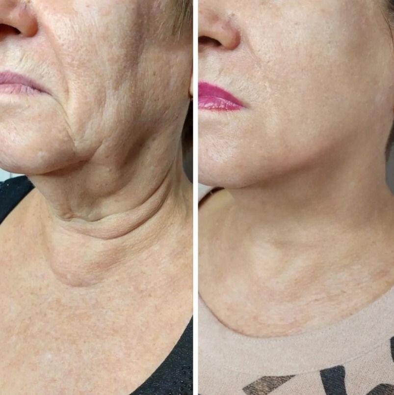 Gisela review photo