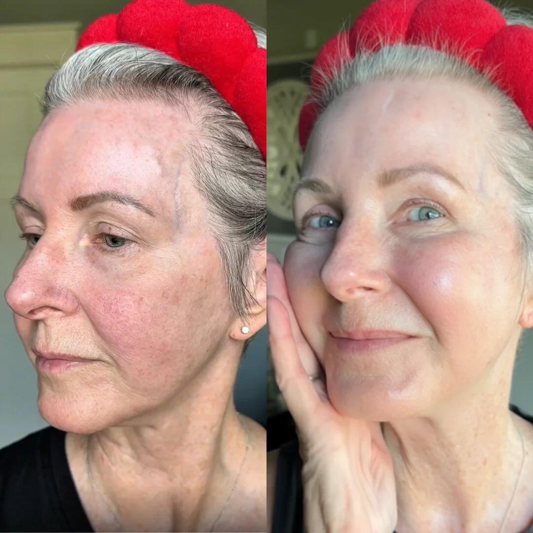 Gisela review photo
