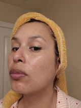 ROX review photo