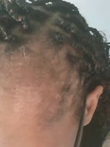Anoint - Hair Growth Oil For Thinning Hair & Edges