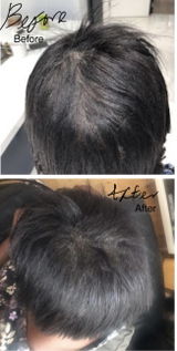 Anoint - Hair Growth Oil For Thinning Hair & Edges