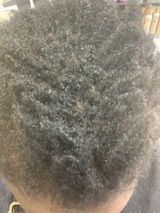 Anoint - Hair Growth Oil For Thinning Hair & Edges