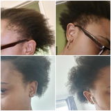 Anoint - Hair Growth Oil For Thinning Hair & Edges