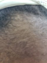 Anoint - Hair Growth Oil For Thinning Hair & Edges
