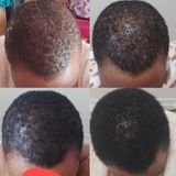 Anoint - Hair Growth Oil For Thinning Hair & Edges