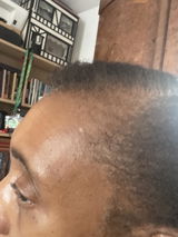 Anoint - Hair Growth Oil For Thinning Hair & Edges