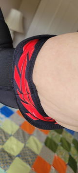 Anonymous review photo