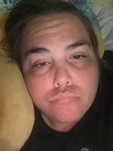 Anonymous review photo