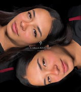 Carlarquejo review photo
