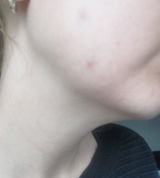 Anon review photo