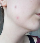 Anon review photo