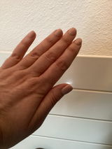 Anonym review photo