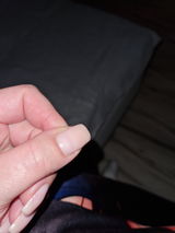 Anonym review photo