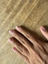 Anonym review photo