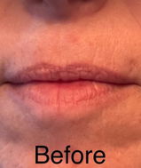 *** review photo