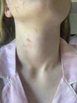 CancelGarnier review photo