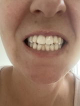 Lisab4 review photo