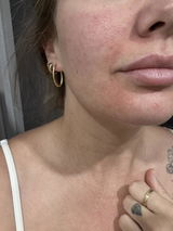 Bettina review photo