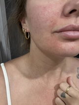 Bettina review photo