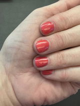 Anonymous review photo