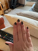 Anonym review photo