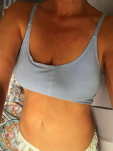 Anonymous review photo