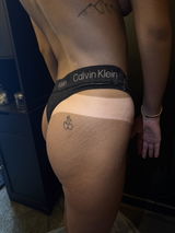 Anonymous review photo