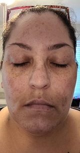 Rosline J. review photo