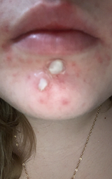 Erin S. review photo