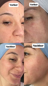 Neri Özdemir review photo