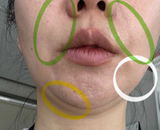 Anonymous review photo