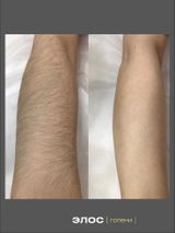 Endrea review photo
