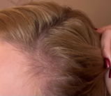 HAIR FOOD - 3 MONTH SUPPLY