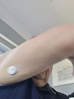 Review picture