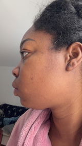 Anonyme review photo