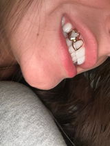 Winni review photo