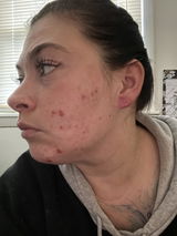 Kerriann Vincent review photo