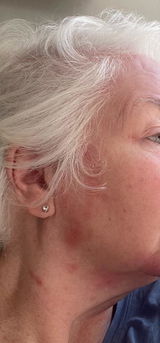 Customer review photo