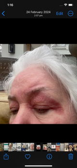 Customer review photo