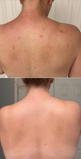 B review photo